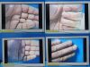 STRYKER ENDOSCOPY Stryker 26" Vision Elect HDTV ,Ref 240-030-960 W/ 240-030-950 PSU ~ Monitor