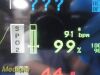 SPACELABS 91370 Ultraview SL Patient Monitor
