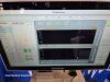 VIASONIX Falcon/PRO - Vascular Physiologic Machine by Ultrasound - OB / GYN - Vascular