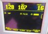GE/COROMETRICS 120 Fetal Monitor