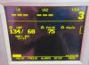 GE/COROMETRICS 120 Fetal Monitor