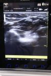 GE HEALTHCARE Venue 40 Ultrasound Machine