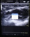 GE HEALTHCARE Venue 40 Ultrasound Machine