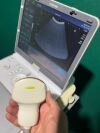 TOSHIBA Viamo Ultrasound Convex probe Portable Ultrasound