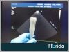 PHILIPS S12-4 SECTOR ARRAY TRANSDUCER PROBE REF 453561270612 TESTED 30 DAYS WARRANTY Ultrasound Transducer