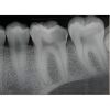 SCHICK CDR Elite Size 2 Dental Sensors