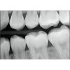 SCHICK CDR Elite Size 2 Dental Sensors