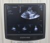 ZONARE Mindray ZS3 Ultrasound System REF 88000-00 W/  P4-1c Transducer - 194754 ZS3