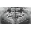 CARESTREAM CS9000 Pan + CBCT with Warranty Dental X-Ray