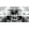 CARESTREAM CS9000 Pan + Ceph + CBCT Dental X-Ray