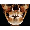 HDX WILL Dentri-C a Pan + Ceph + CBCT with PC, Software, Installation, Shipping and Warranty Dental X-Ray