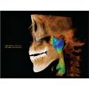 HDX WILL Dentri-C a Pan + Ceph + CBCT with PC, Software, Installation, Shipping and Warranty Dental X-Ray