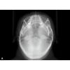 HDX WILL Dentri-C a Pan + Ceph + CBCT with PC, Software, Installation, Shipping and Warranty Dental X-Ray