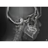 HDX WILL Dentri-C a Pan + Ceph + CBCT with PC, Software, Installation, Shipping and Warranty Dental X-Ray