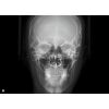 HDX WILL Dentri-C a Pan + Ceph + CBCT with PC, Software, Installation, Shipping and Warranty Dental X-Ray