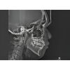 HDX WILL Dentri-C a Pan + Ceph + CBCT with PC, Software, Installation, Shipping and Warranty Dental X-Ray