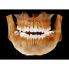 HDX WILL Dentri-C a Pan + Ceph + CBCT with PC, Software, Installation, Shipping and Warranty Dental X-Ray