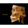 HDX WILL Dentri-C a Pan + Ceph + CBCT with PC, Software, Installation, Shipping and Warranty Dental X-Ray