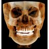HDX WILL Dentri-C a Pan + Ceph + CBCT with PC, Software, Installation, Shipping and Warranty Dental X-Ray
