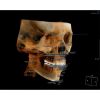 HDX WILL Dentri-C a Pan + Ceph + CBCT with PC, Software, Installation, Shipping and Warranty Dental X-Ray