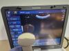 TOSHIBA viamo SSA-640A SSA 640 ultrasound with convex + linear transducer probe Ultrasound Transducer