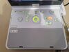 TOSHIBA viamo SSA-640A SSA 640 ultrasound with convex + linear transducer probe Ultrasound Transducer
