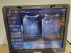 TOSHIBA viamo SSA-640A SSA 640 ultrasound with convex + linear transducer probe Ultrasound Transducer