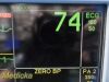 GE 2005  Dash 5000, (CO2, NBP, IBP, ECG, SpO2, Temp) W/ NEW Leads ~ Monitor
