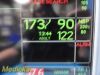 GE 2005  Dash 5000, (CO2, NBP, IBP, ECG, SpO2, Temp) W/ NEW Leads ~ Monitor