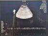 FUJINON EB-530 US linear ultrasonic broncho scope video endoscope EBUS Endoscope