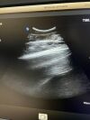 PHILIPS C9-2 989605391091 Ultrasound Transducer