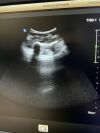 PHILIPS C9-2 989605391091 Ultrasound Transducer