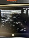 PHILIPS L12-3 Ultrasound Transducer