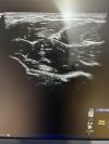GE ML6-15-D Ultrasound Transducer