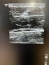 GE 9L-D Ultrasound Transducer