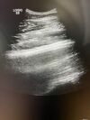 GE C2-9-D Ultrasound Transducer