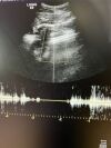 GE C2-9-D Ultrasound Transducer