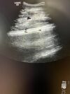 GE C2-9-D Ultrasound Transducer