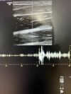 GE 9L-D Ultrasound Transducer