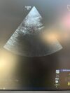 GE 6Tc Ultrasound Transducer