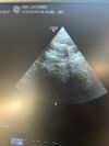 GE 6Tc Ultrasound Transducer