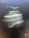 GE HEALTHCARE GE M6C Ultrasound Transducer