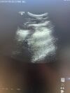 GE HEALTHCARE GE M6C Ultrasound Transducer