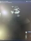 GE S1-5 -D Ultrasound Transducer Probe