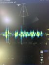 GE S1-5 -D Ultrasound Transducer Probe