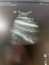 GE HEALTHCARE C1-5-D Ultrasound Transducer