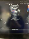 PHILIPS C5-1 Ultrasound Transducer