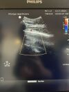 PHILIPS C5-1 Ultrasound Transducer