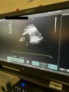 SIEMENS Acuson X700 Ultrasound  with 3 Probes