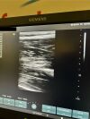 SIEMENS Acuson X700 Ultrasound  with 3 Probes